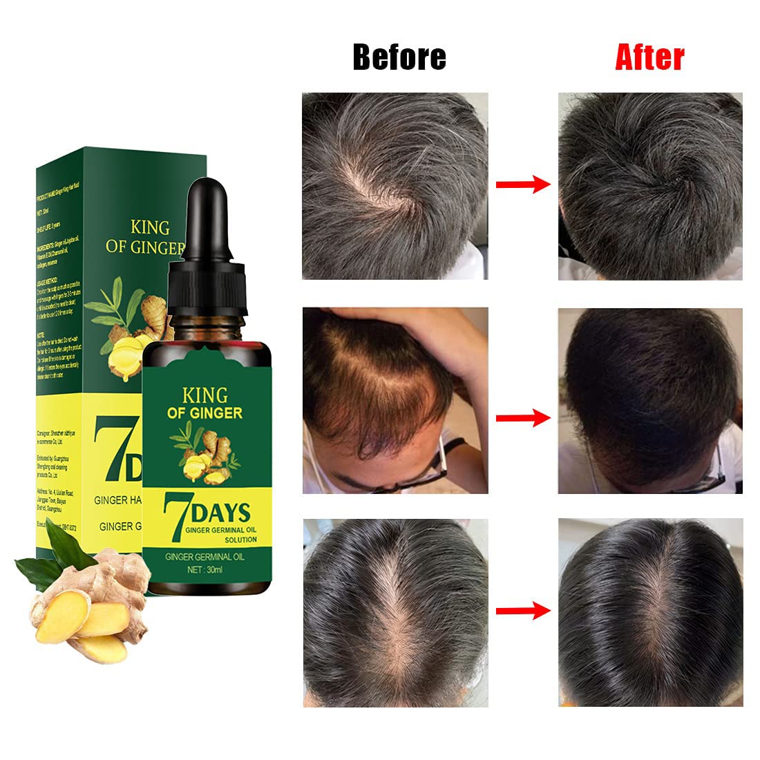 1DFAUL Ginger Hair Growth Germinal Oil close-up showing nourished roots