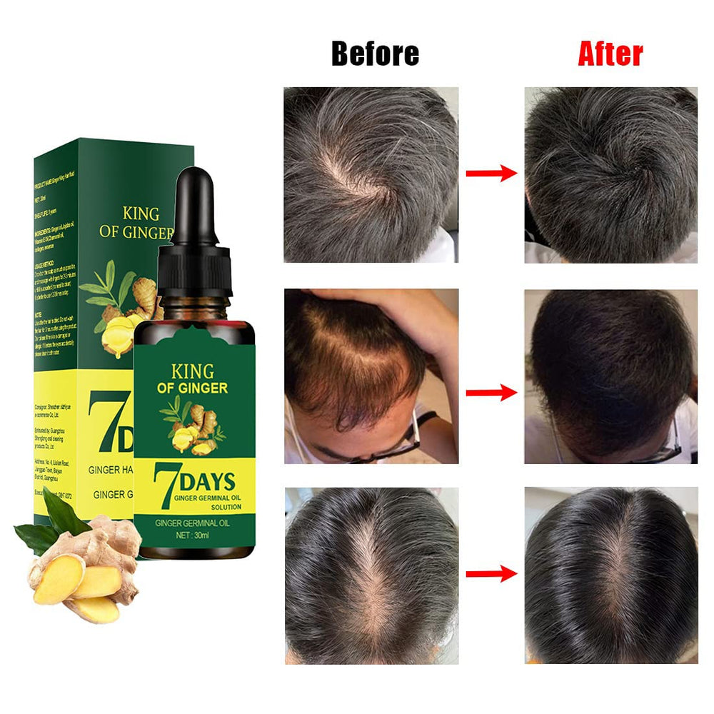 1DFAUL Ginger Hair Growth Germinal Oil close-up showing nourished roots