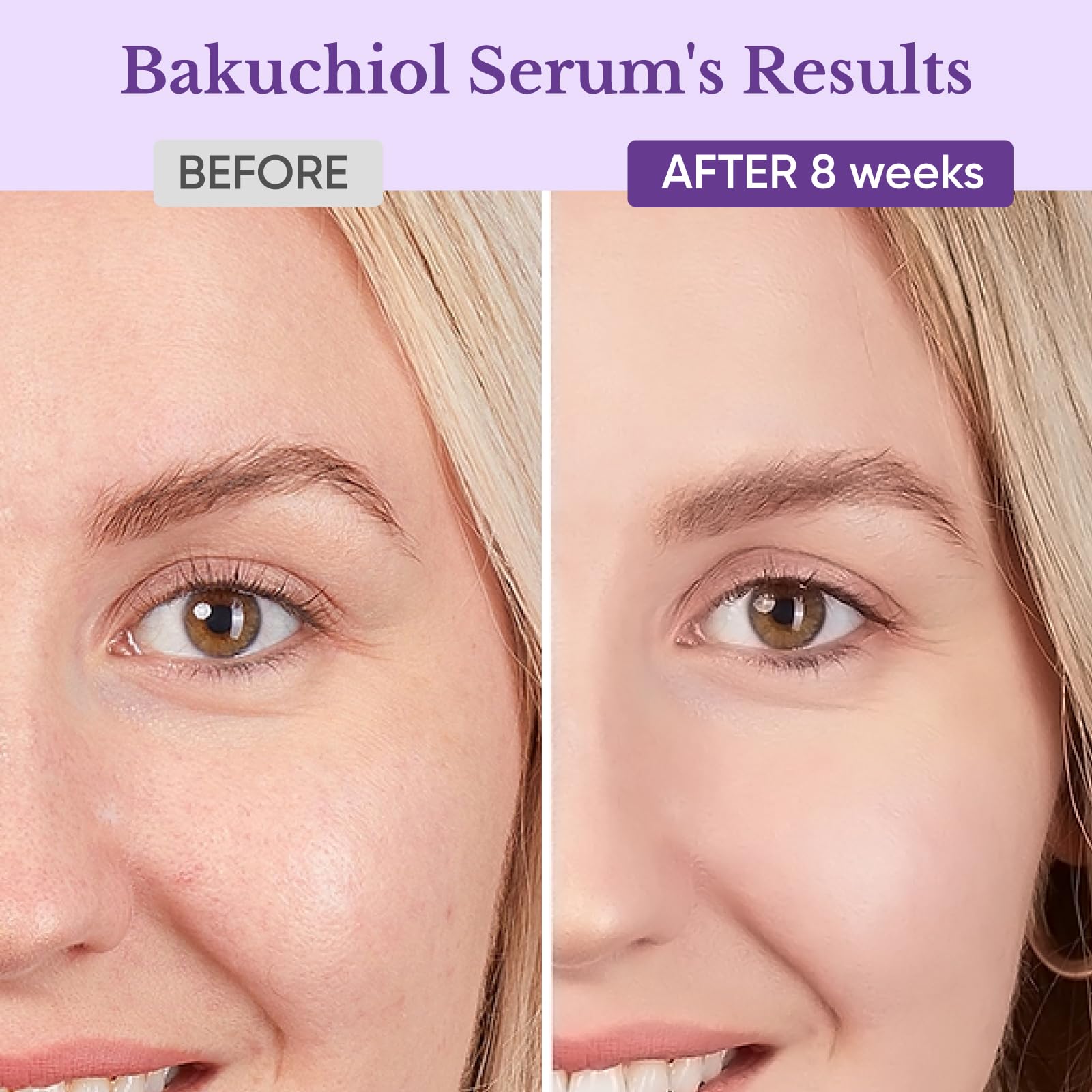1HEROLABS Bakuchiol serum texture close-up shows fast-absorbing hydration.