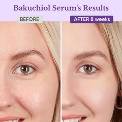 1HEROLABS Bakuchiol serum texture close-up shows fast-absorbing hydration.