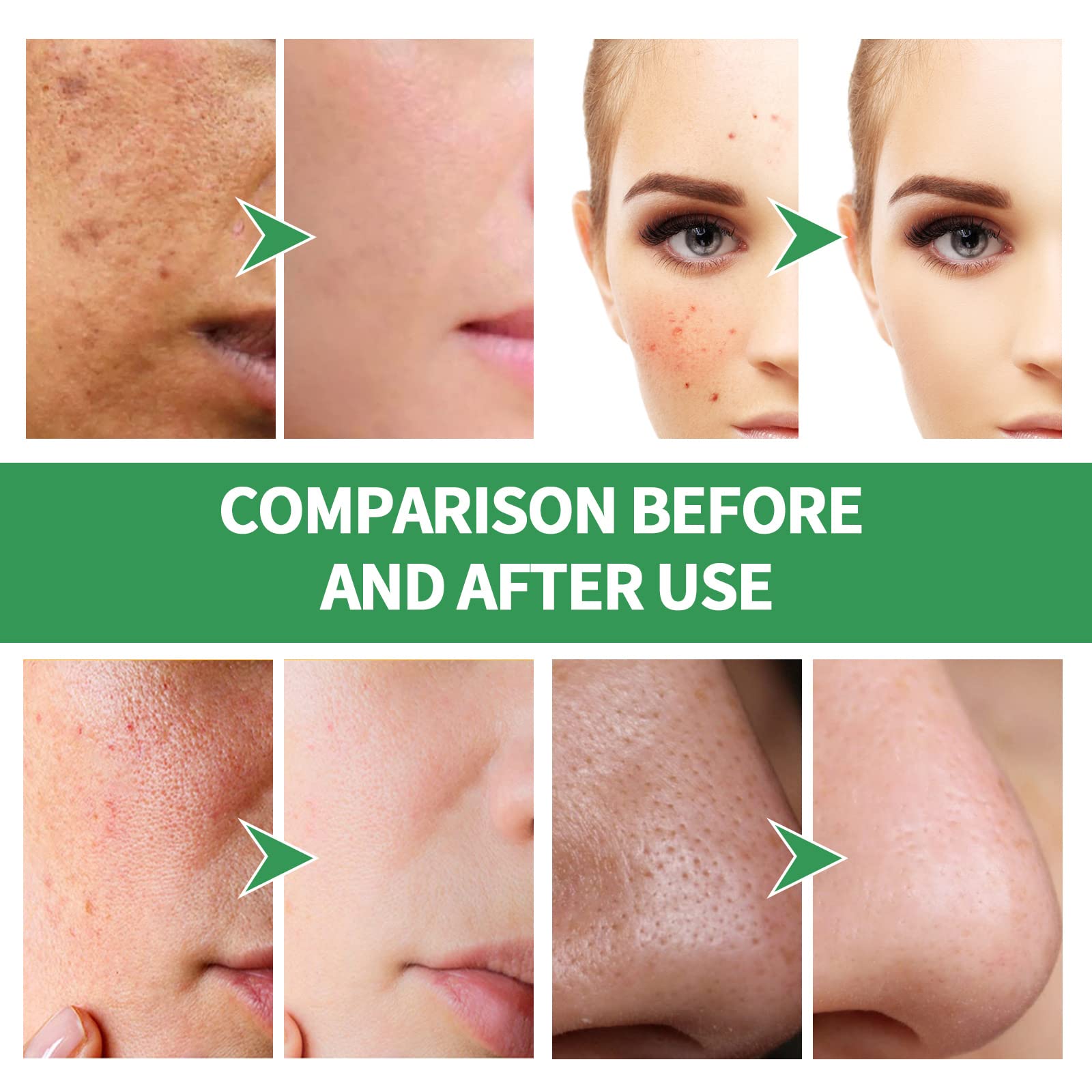 Mask worn on face with bubbles for cleansing