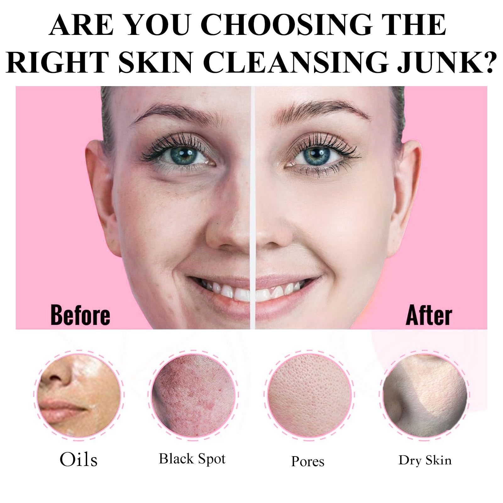 Aaenouicfs Eggplant mud mask unclogs pores for clearer skin