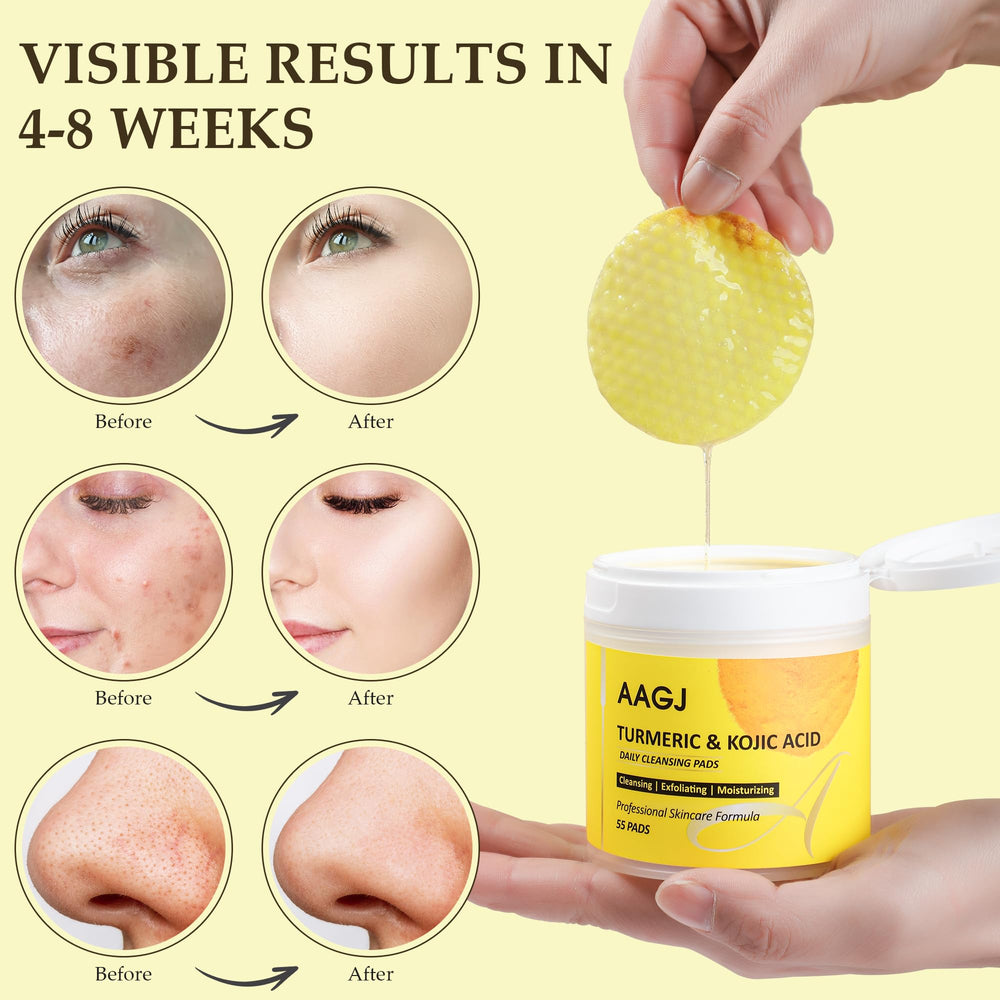 AAGJ Turmeric Kojic Acid Cleansing Pads suitable for all skin types.