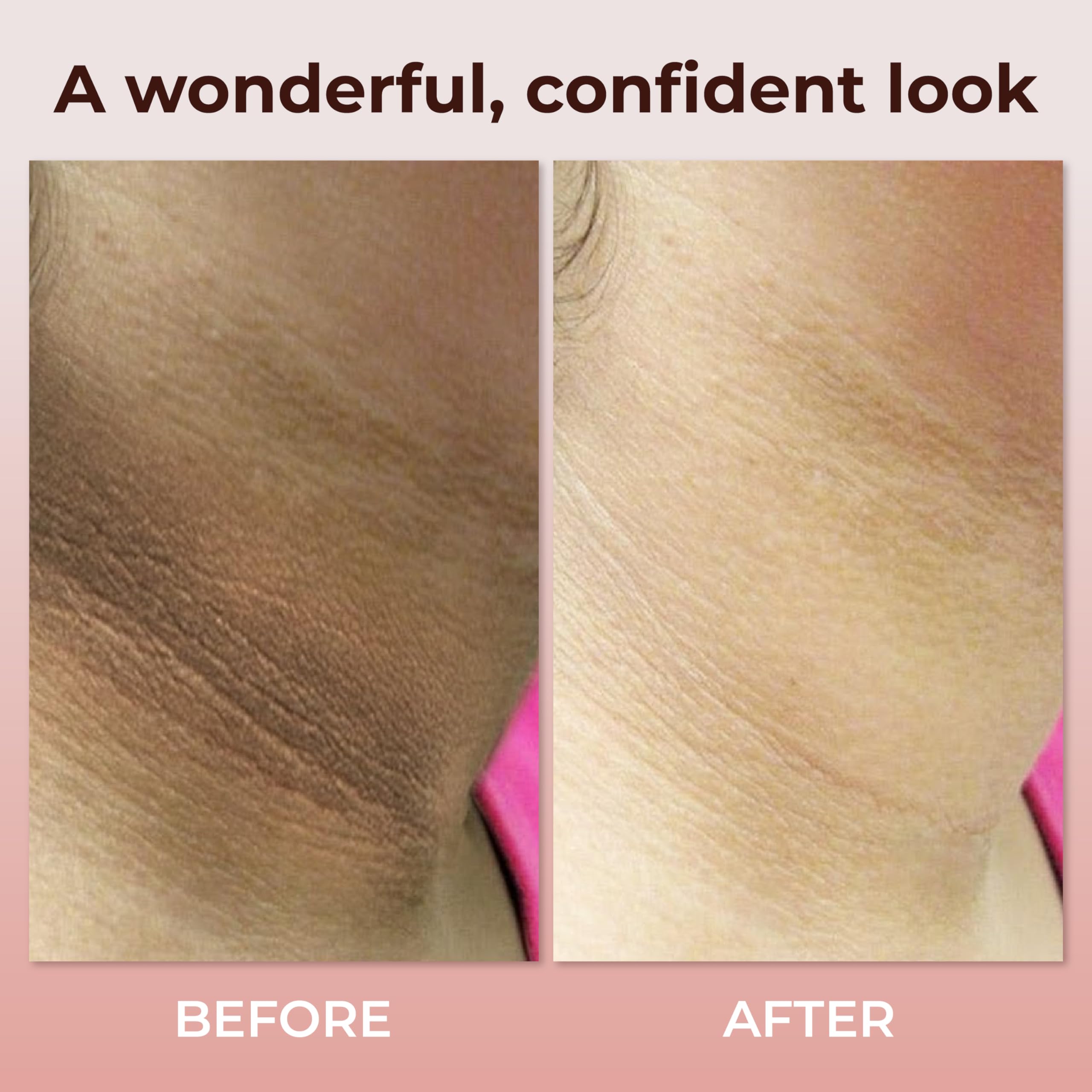 Applying ABERA neck cream to neck skin for even tone and texture