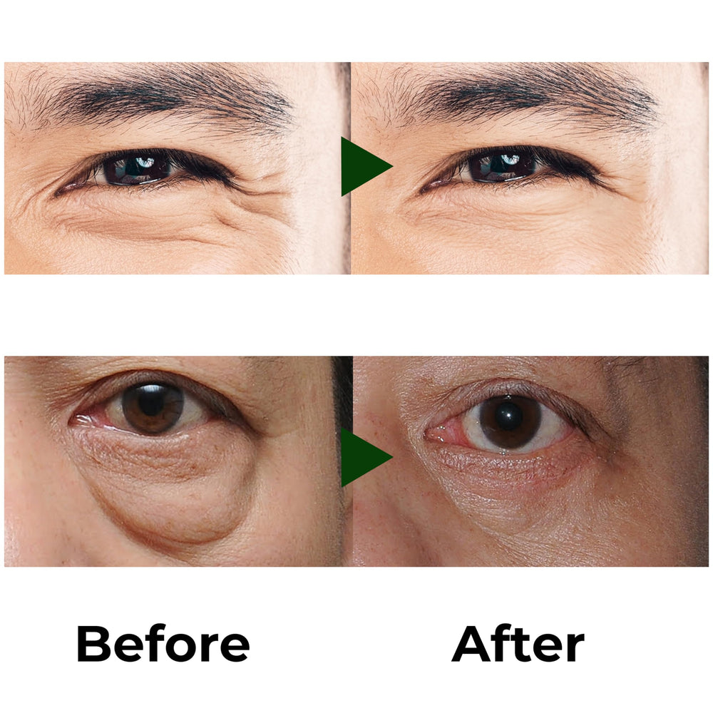 ABERA eye serum improves firmness and elasticity for a lifted eye area