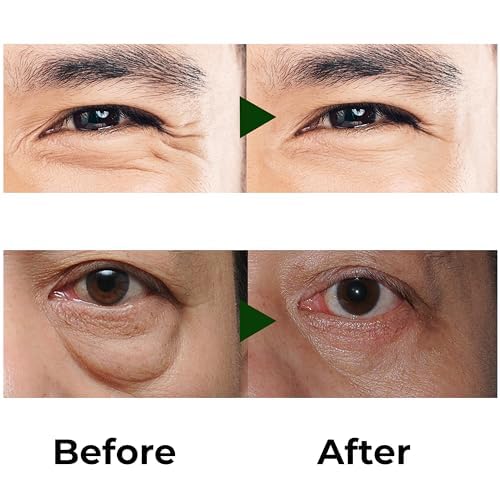ABERA Eye Roller Serum targets under-eye puffiness for a refreshed appearance.