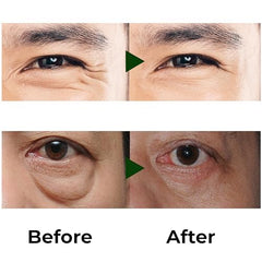 ABERA Eye Roller Serum targets under-eye puffiness for a refreshed appearance.