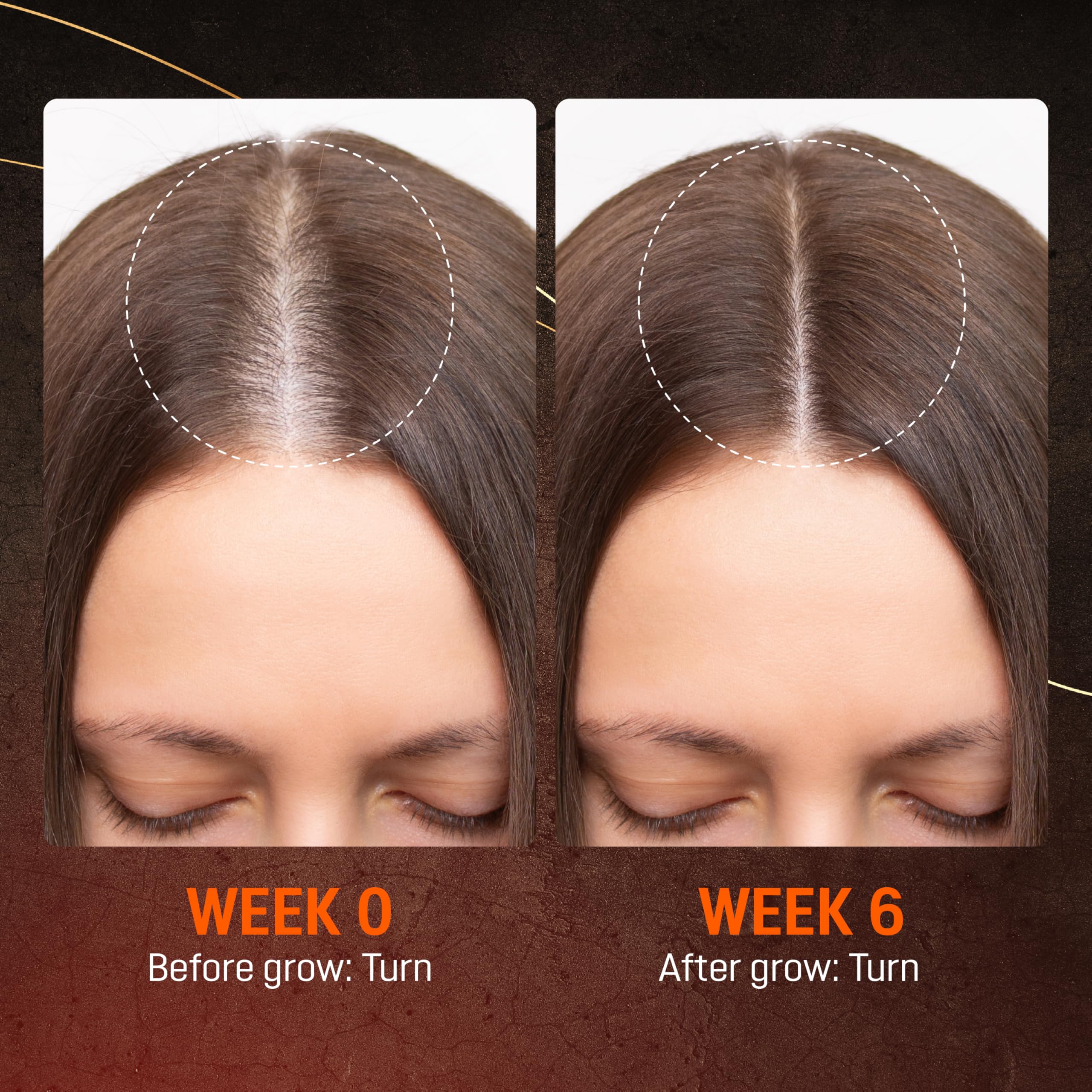 ABERA application scene on the scalp demonstrates an easy daily routine