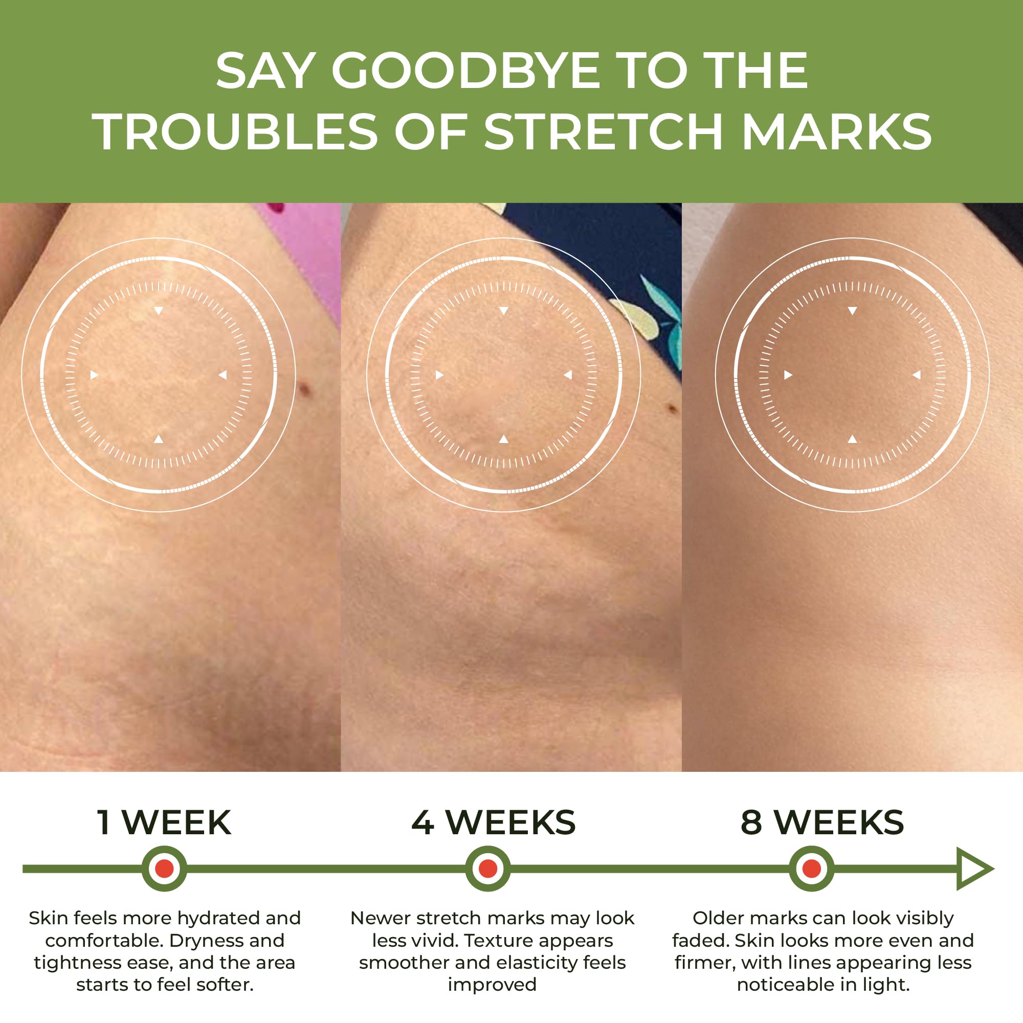 ABERA belly skin after application with hydration and glow