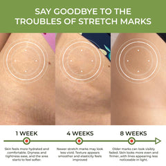 ABERA belly skin after application with hydration and glow