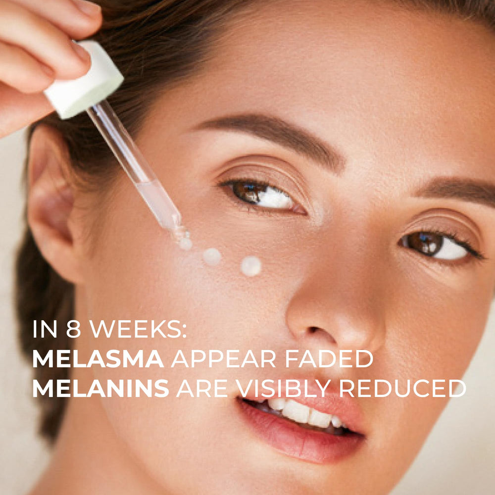ABERA Melasma Serum packaging box on display.