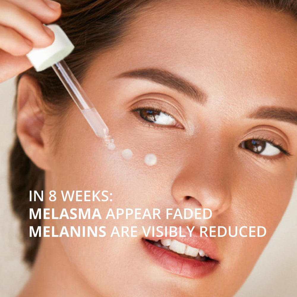 ABERA Melasma Serum Plus Genowhite graphic highlights key actives and benefits.