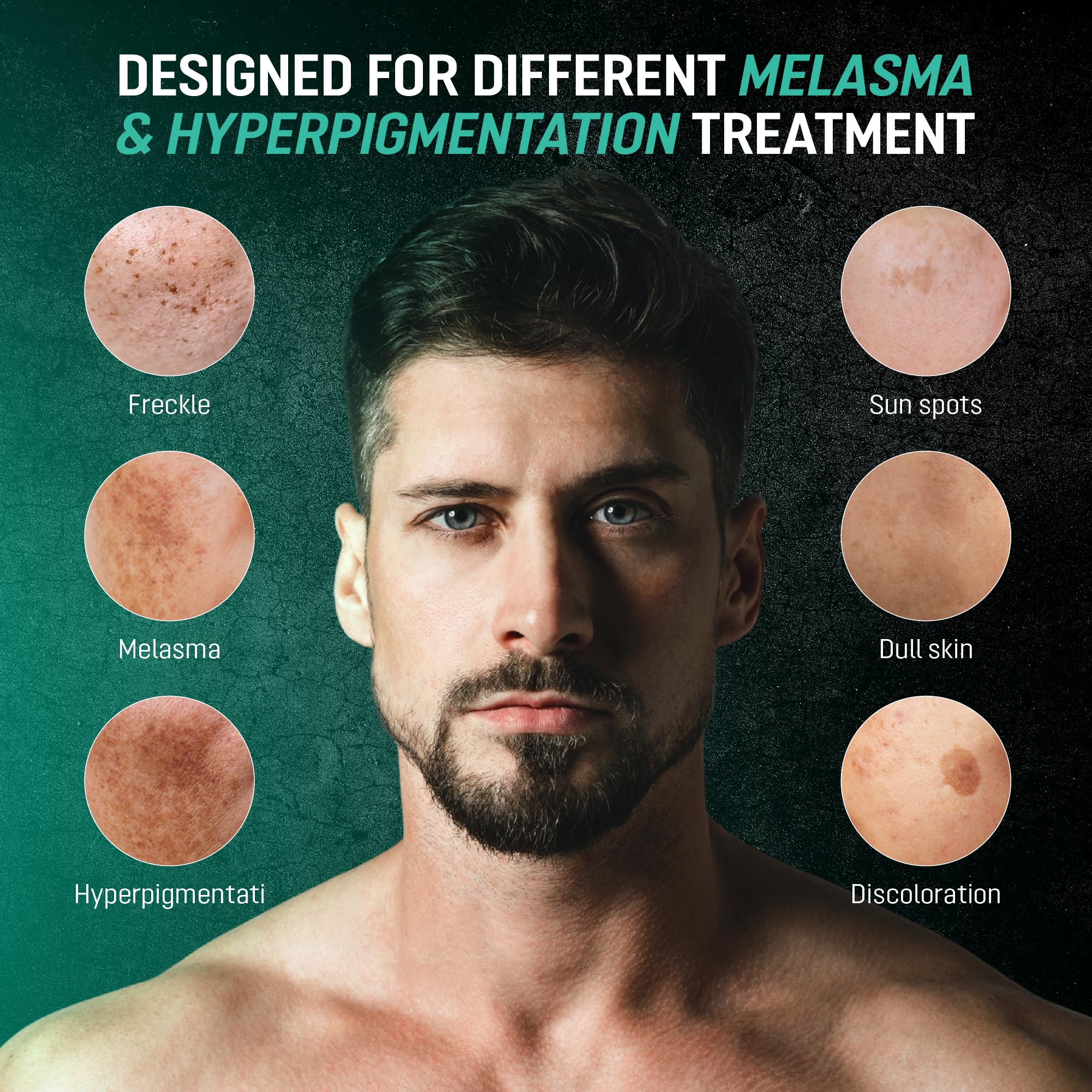 Before-and-after style note on dark spots improvement with ABERA.
