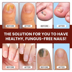 ABERA quick-dry formula on nails with fast absorption and non-greasy finish.