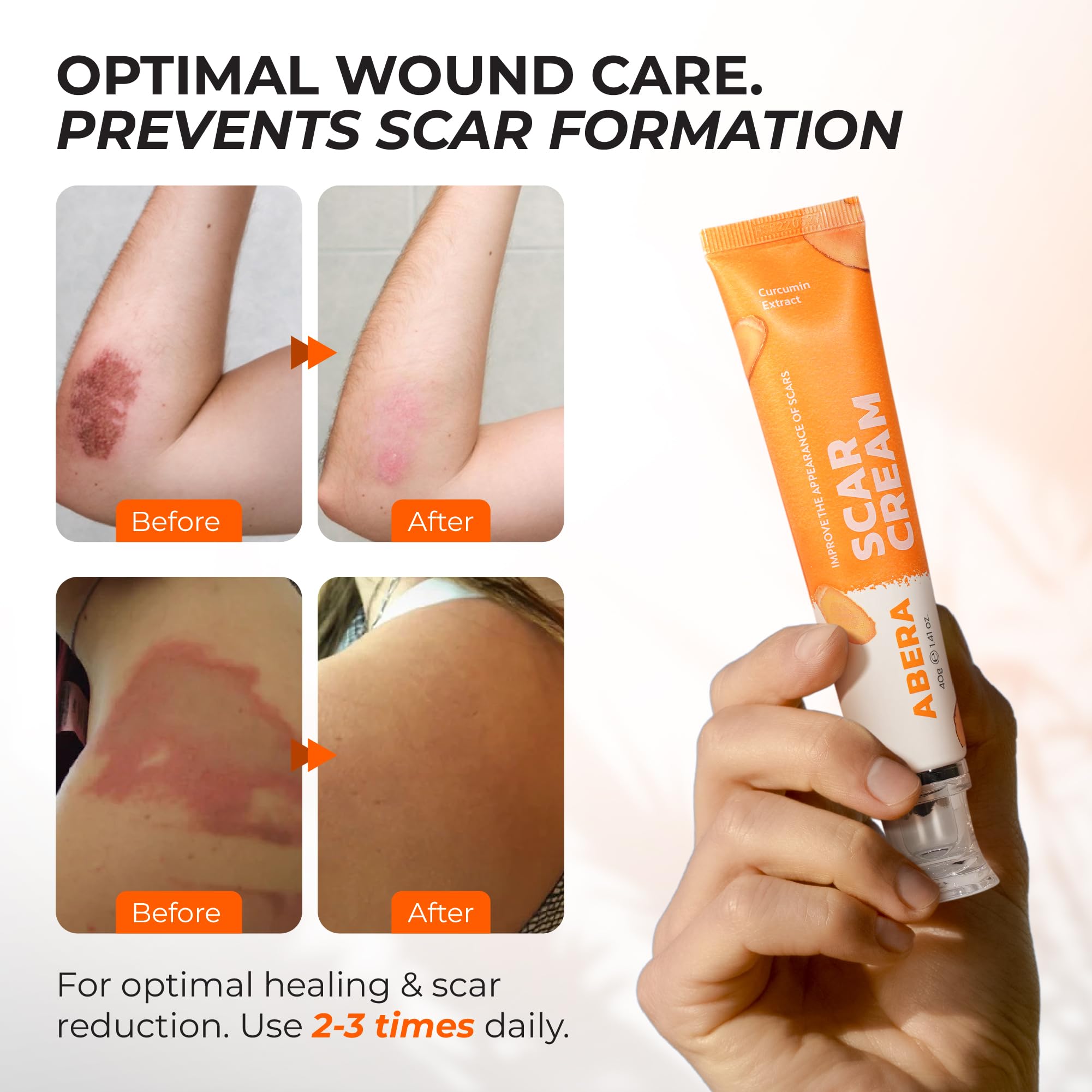 Packaging highlights protective barrier feature for damaged skin.