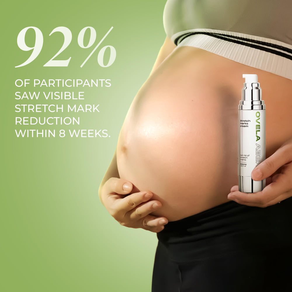 ABERA stretch-mark cream tube packaging for daily use