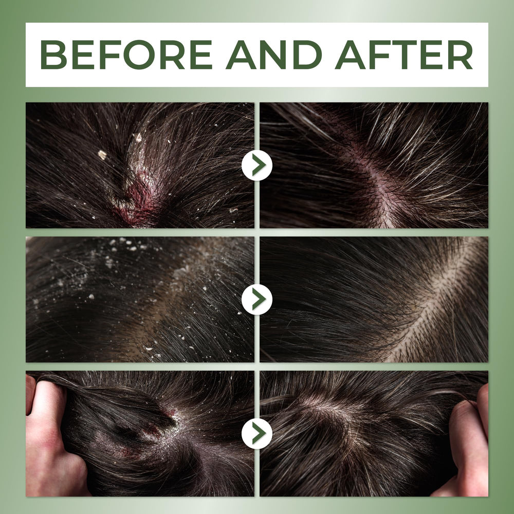 ABERA sulfate-free paraben-free formula emphasizes safe care for sensitive scalps.