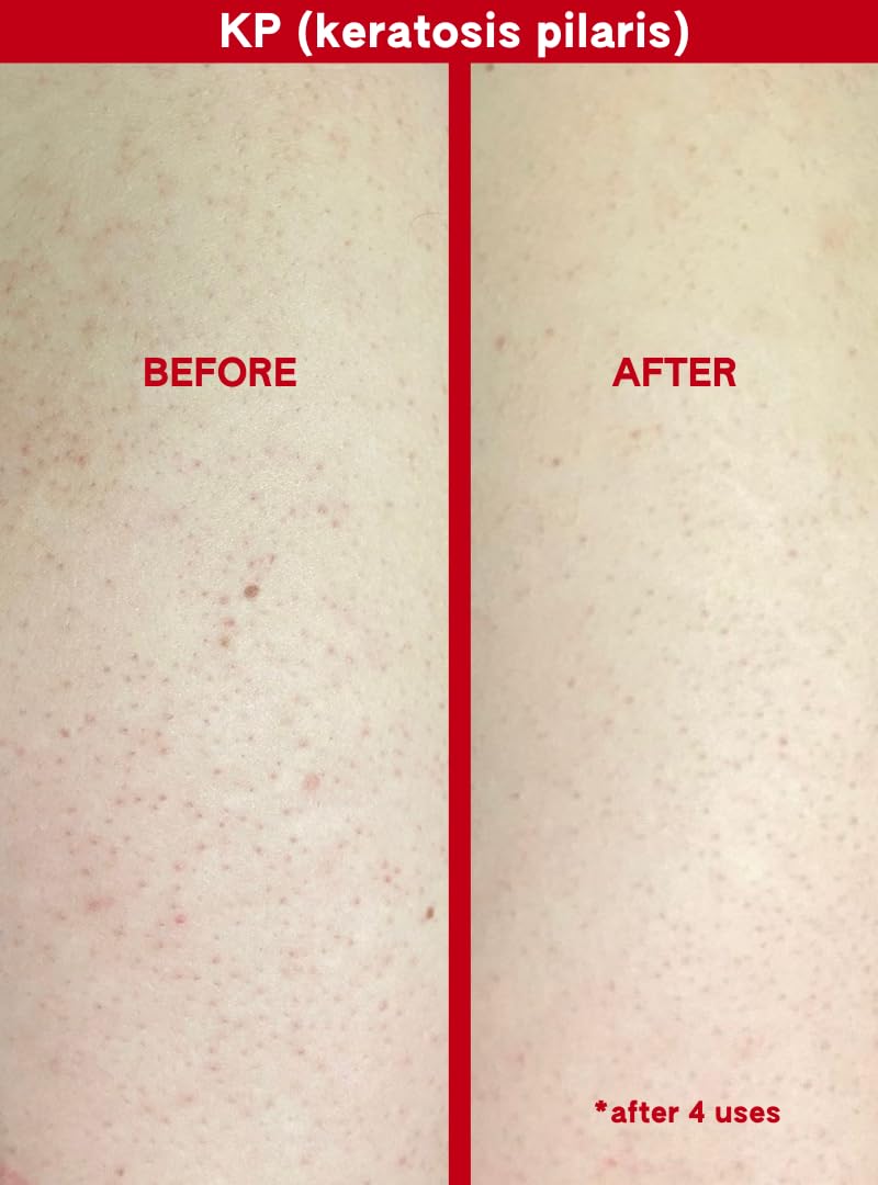 Abi Ame Exfoliant 150ml bottle shown for long-lasting skin prep