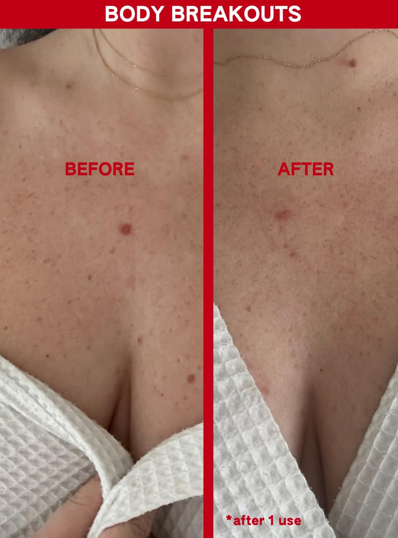Abi Ame Exfoliant after rinse reveals smoother, refined skin