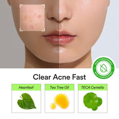 Abib Heartleaf Calming Spot Patch 12mm 30-pack for larger blemishes.