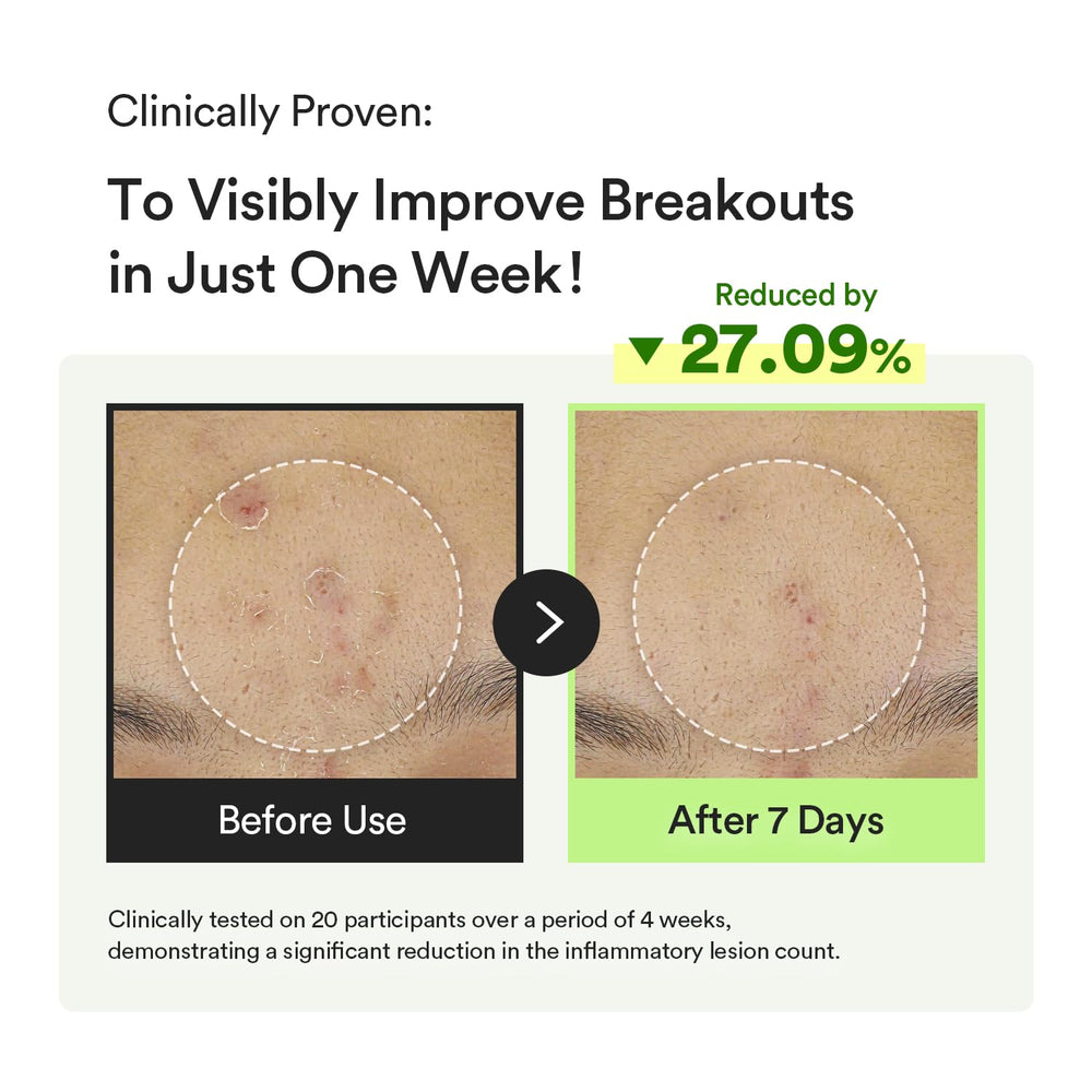 Abib Heartleaf TECA Capsule Serum being applied to the skin.