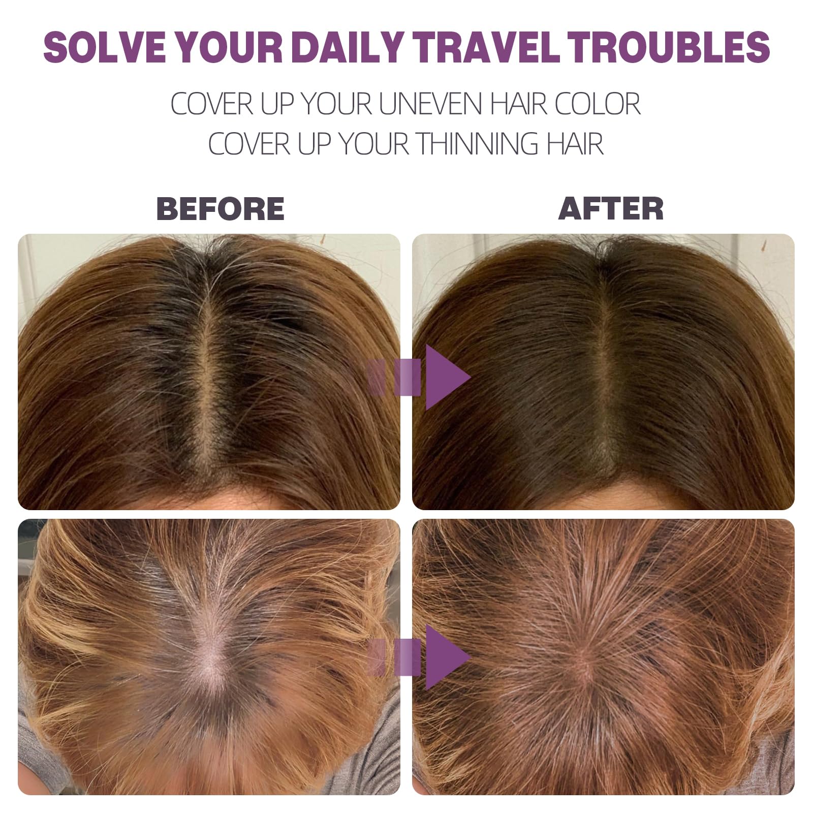 Abomet Hairline Powder on hairline application demonstrating easy brush-on feel.
