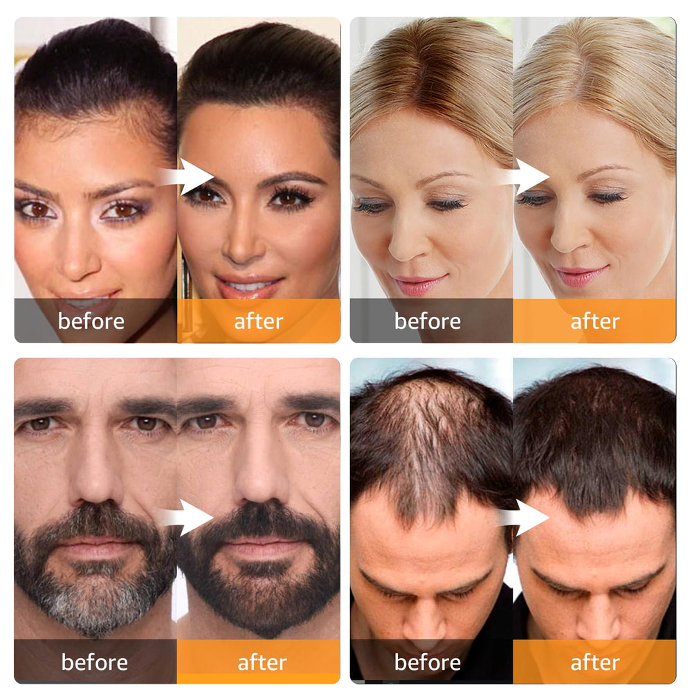 Abomet Root Touch Up Powder being applied to the hairline for quick coverage.