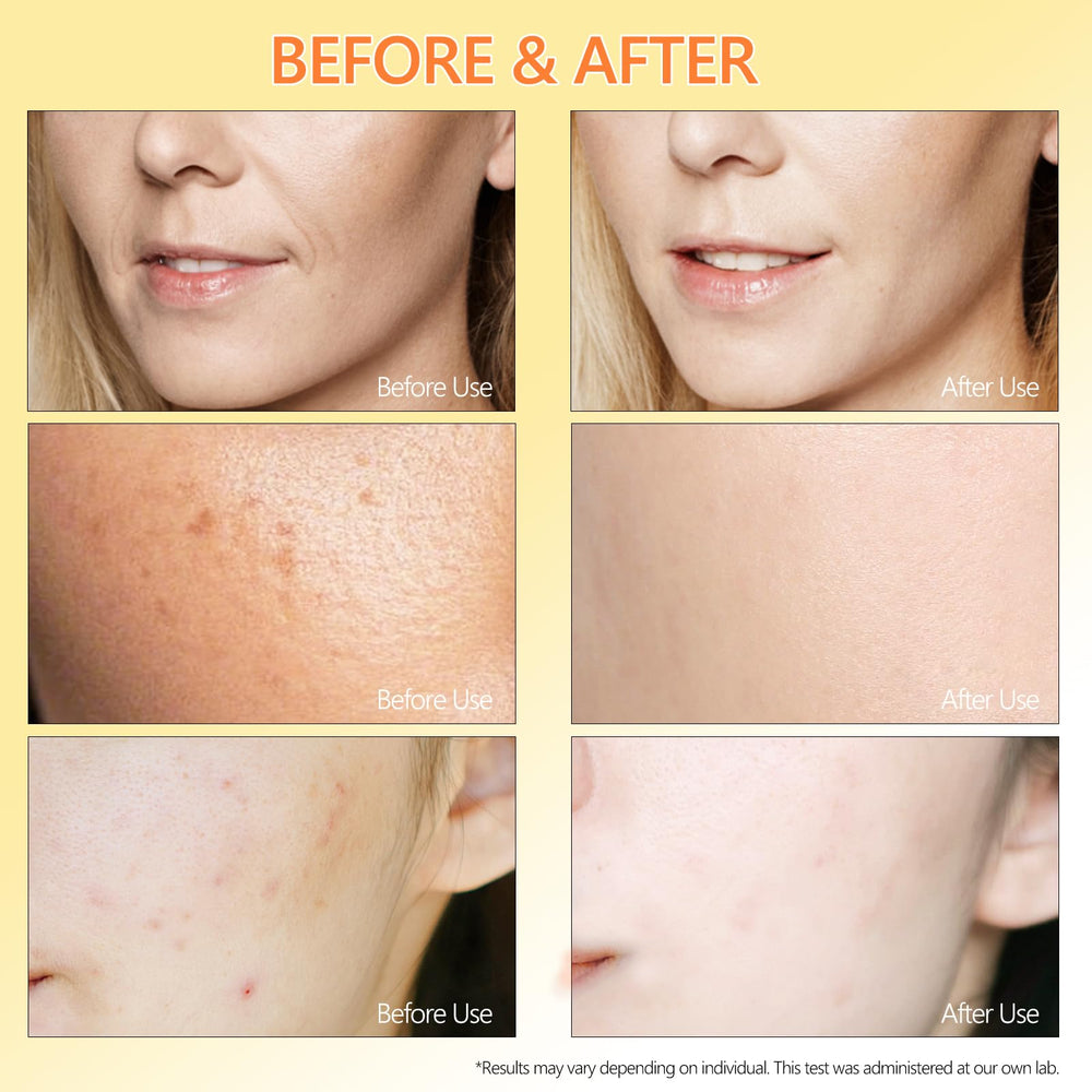 ABOTE hyaluronic acid 1 percent shot indicating deep hydration