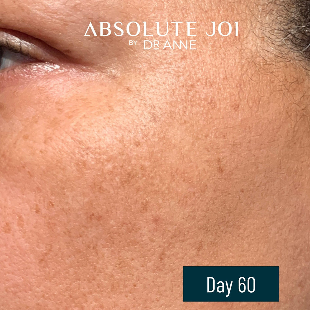 AbsoluteJOI vitamin C and retinol working together for glow.