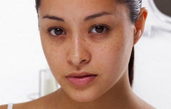 ACM Depiwhite cream on skin shows targeted application for noticeable brightening