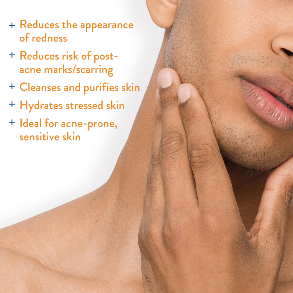 AcneFree after-workout skin mist application for post-exercise calm.