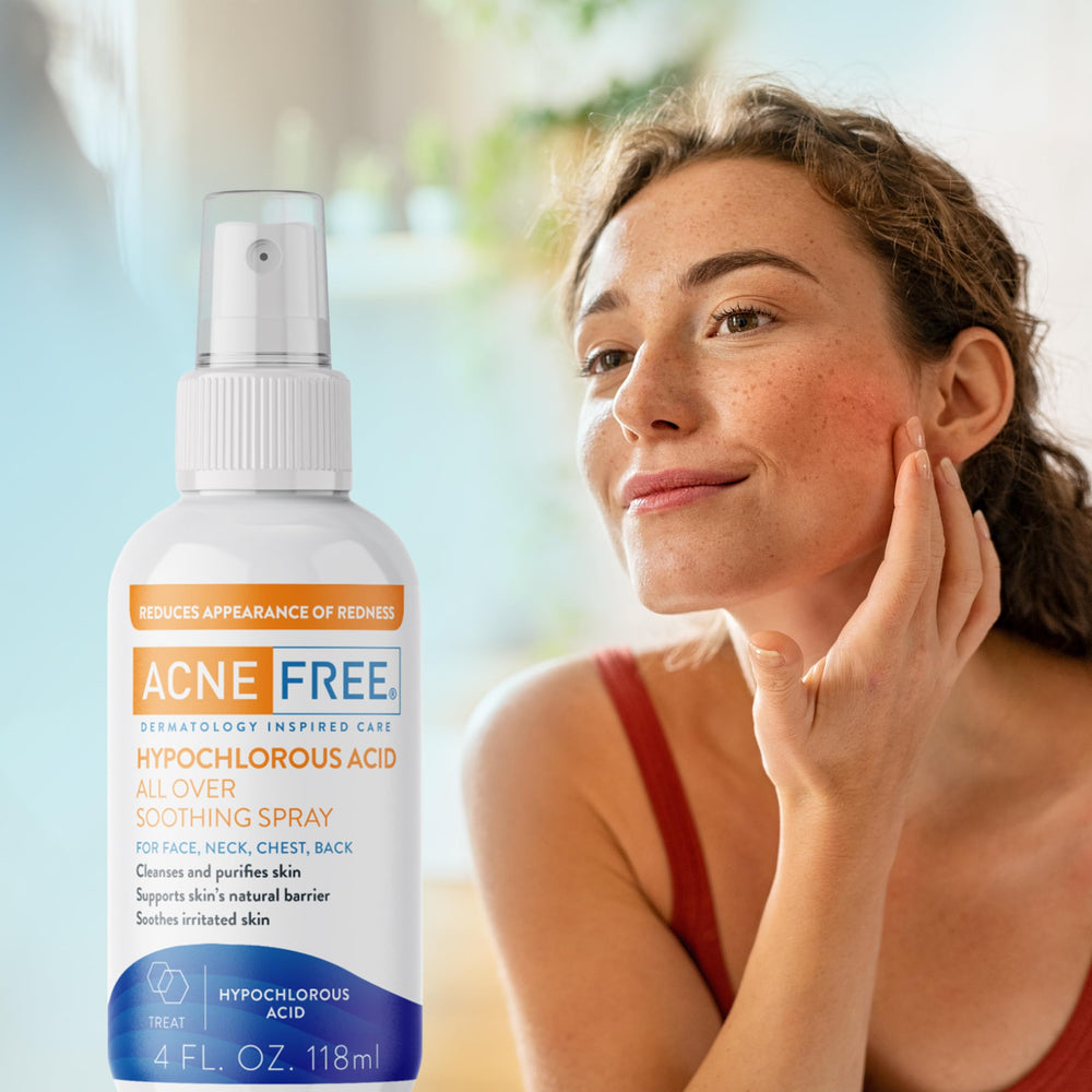 AcneFree face mist application demonstrating easy, on-the-go use for irritated skin.