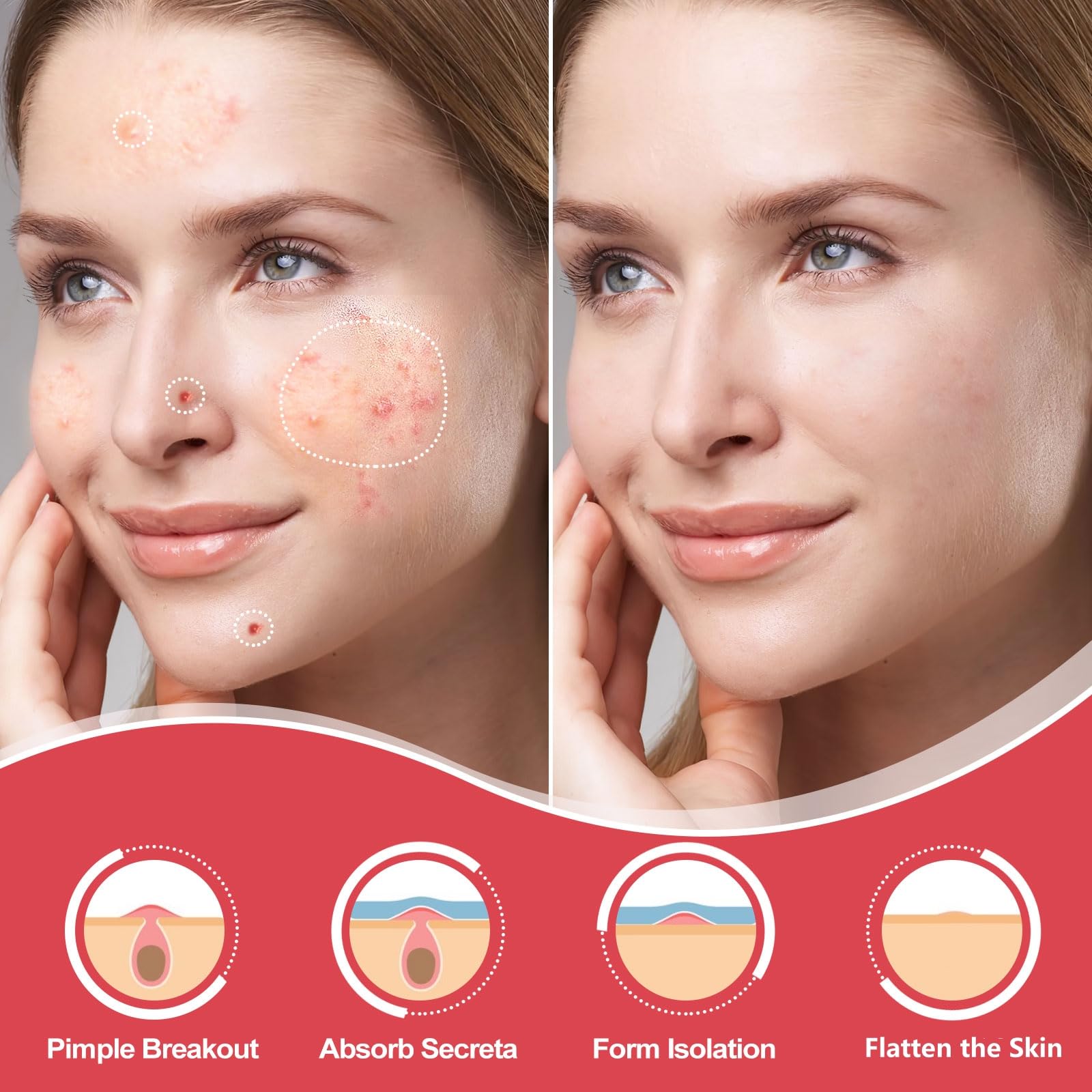AcneGo patches maintain strong adhesion during sleep and daily movements.