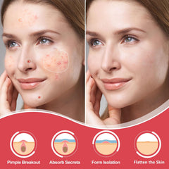 AcneGo patches maintain strong adhesion during sleep and daily movements.