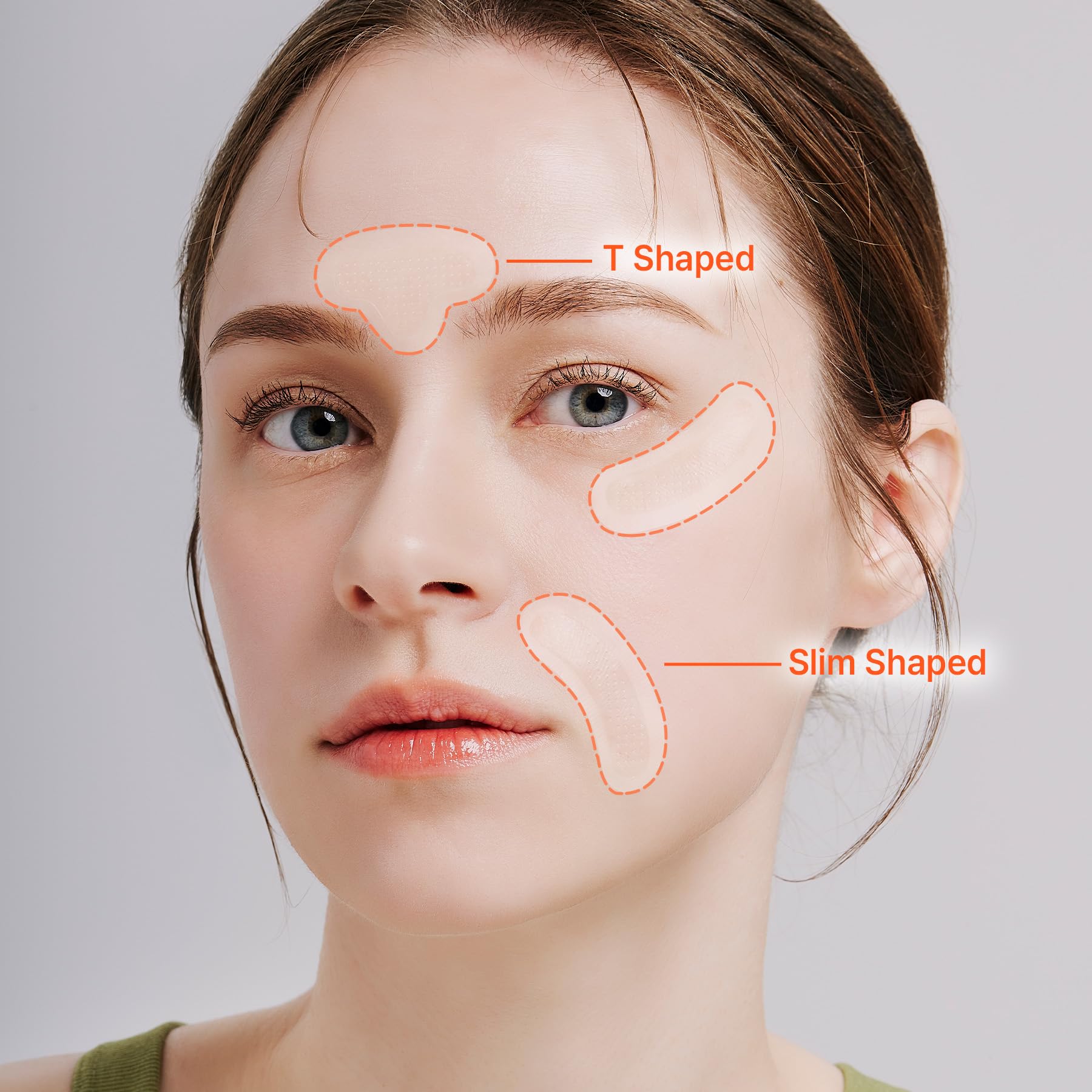 Acropass RETI-RN Microcone patch in T-shape on facial contours