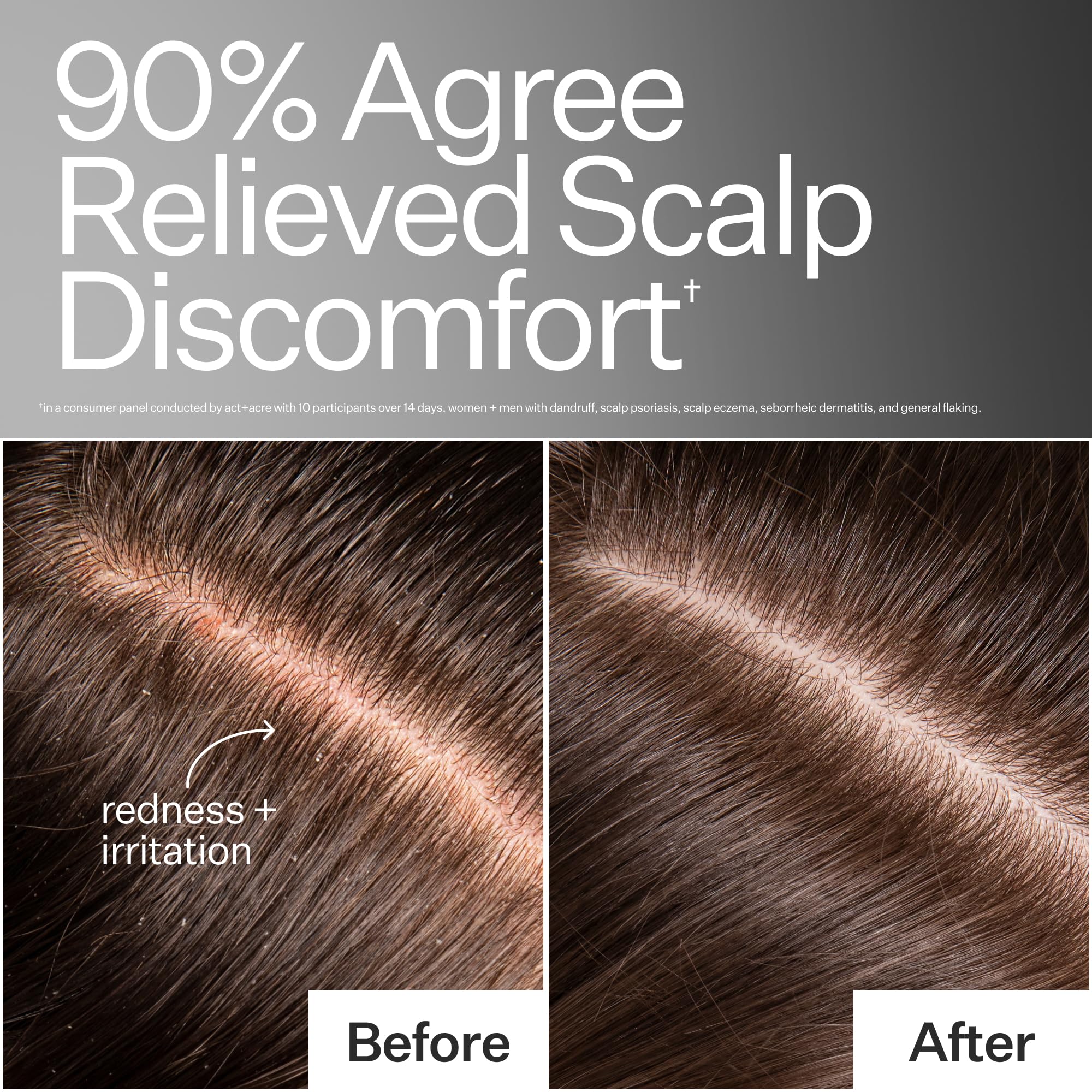 ACT+ ACRE bottle close-up with ingredients label and paraben-free formulation