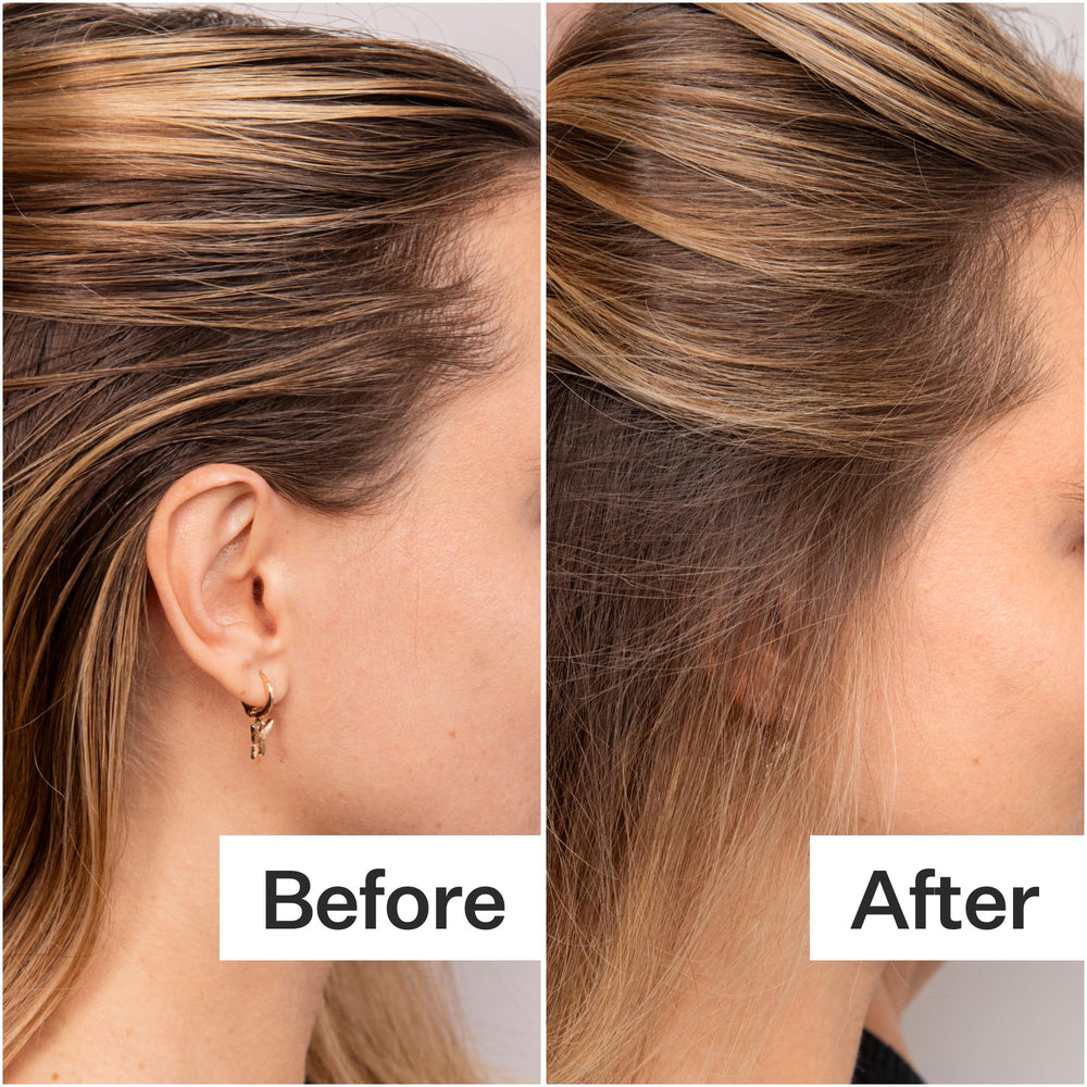 ACT+ACRE unscented formula shown, aerosol-free and gentle on scalp