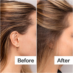 ACT+ACRE unscented formula shown, aerosol-free and gentle on scalp