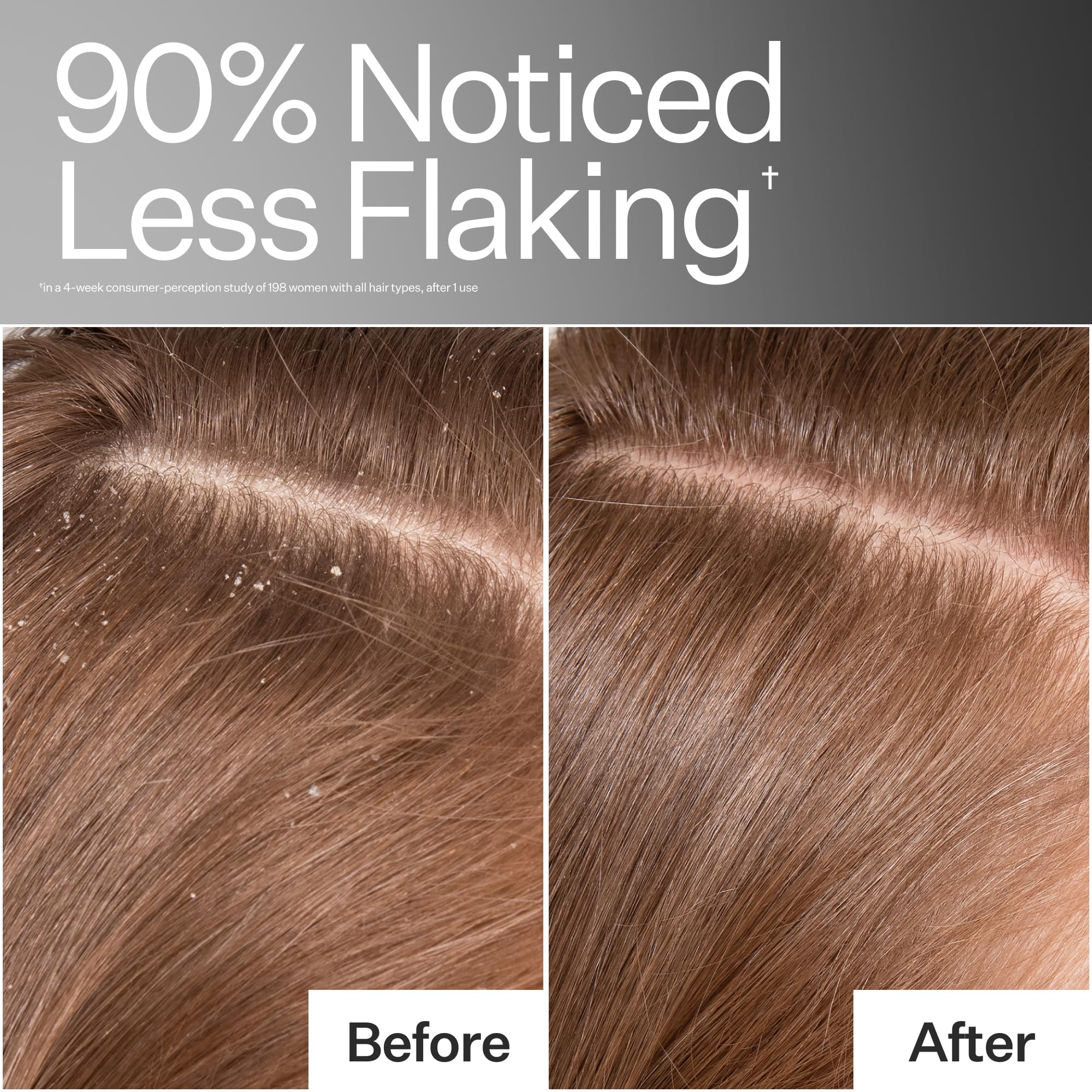 ACT+ ACRE Baobab Oil nutrients nourishing hair follicles for vitality.