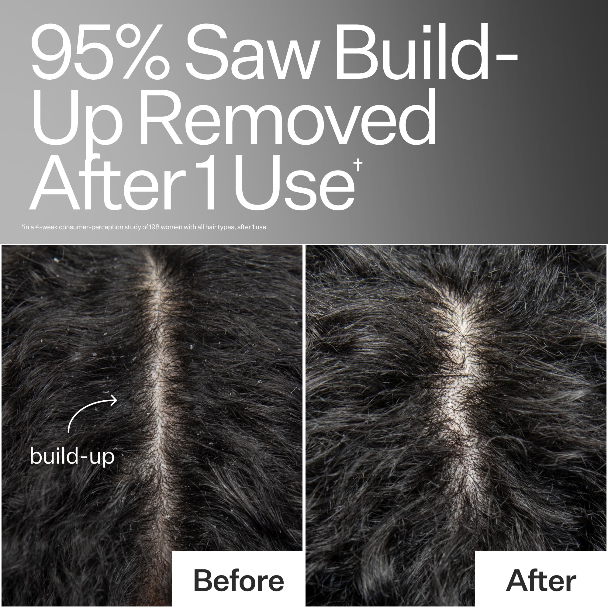 ACT+ ACRE Basil Leaf hydration for the scalp, celebrating botanical nourishment.