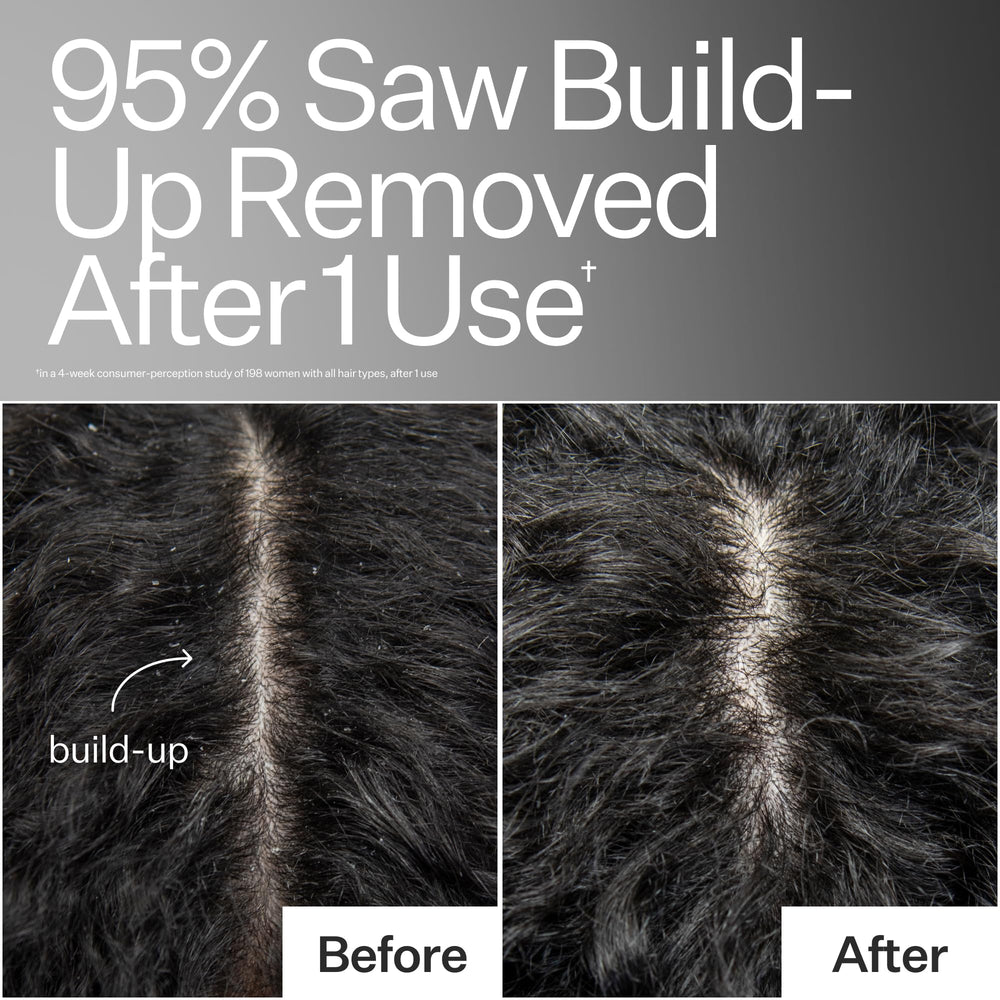 ACT+ ACRE Basil Leaf hydration for the scalp, celebrating botanical nourishment.
