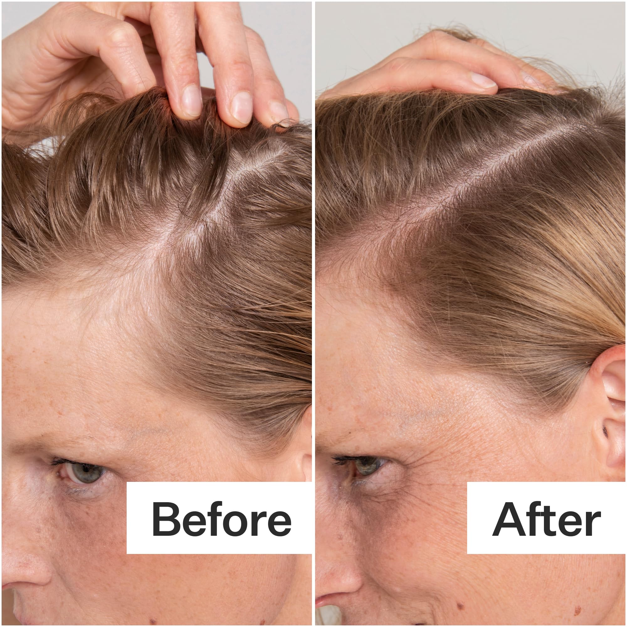 ACT+ACRE papaya extract label close-up hints gentle exfoliation.