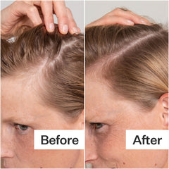 ACT+ACRE papaya extract label close-up hints gentle exfoliation.