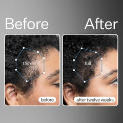 Close-up of ACT+ ACRE stem cell serum highlights premium formula for healthier scalp.