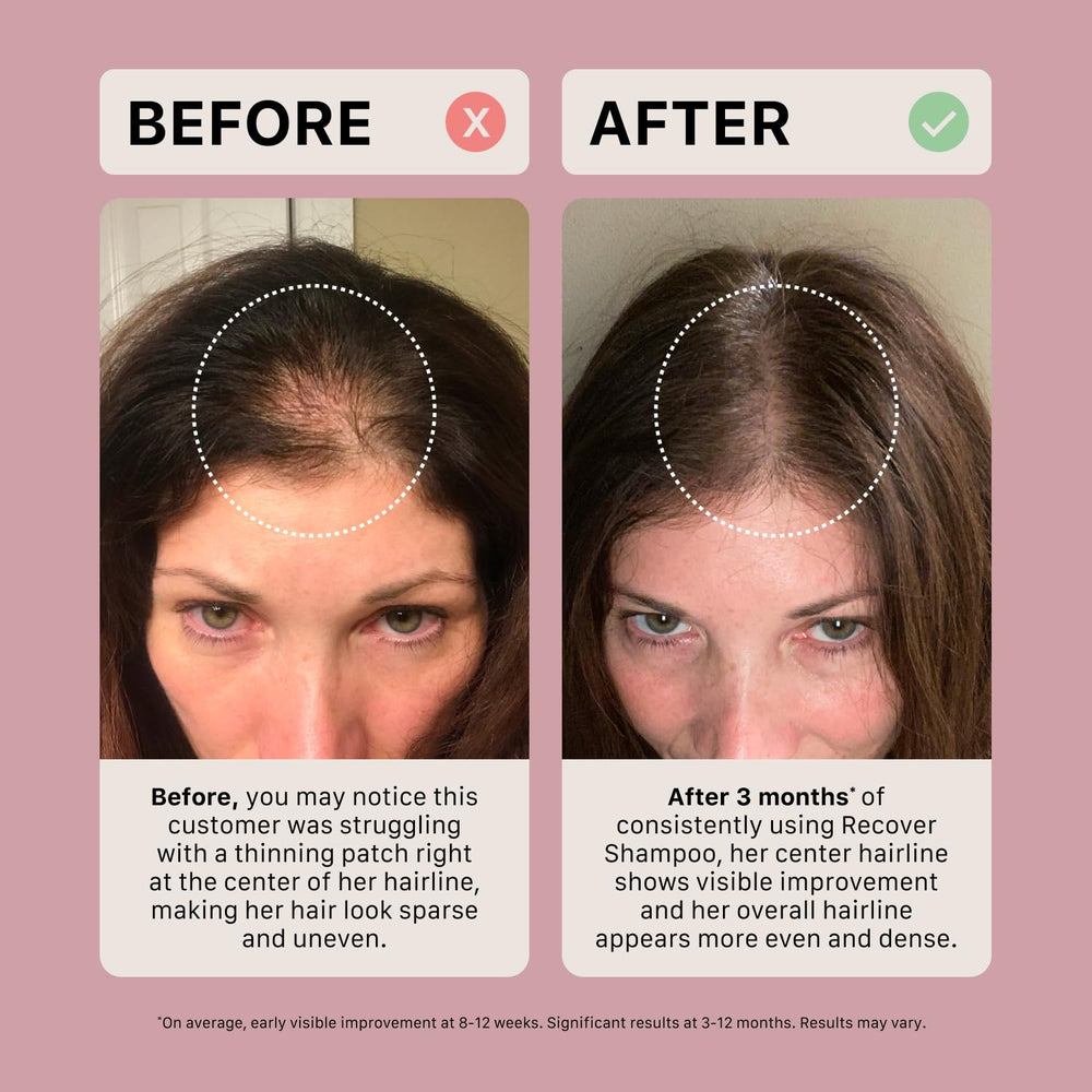 ACTIIV Recover packaging highlighting plant-based ingredients.
