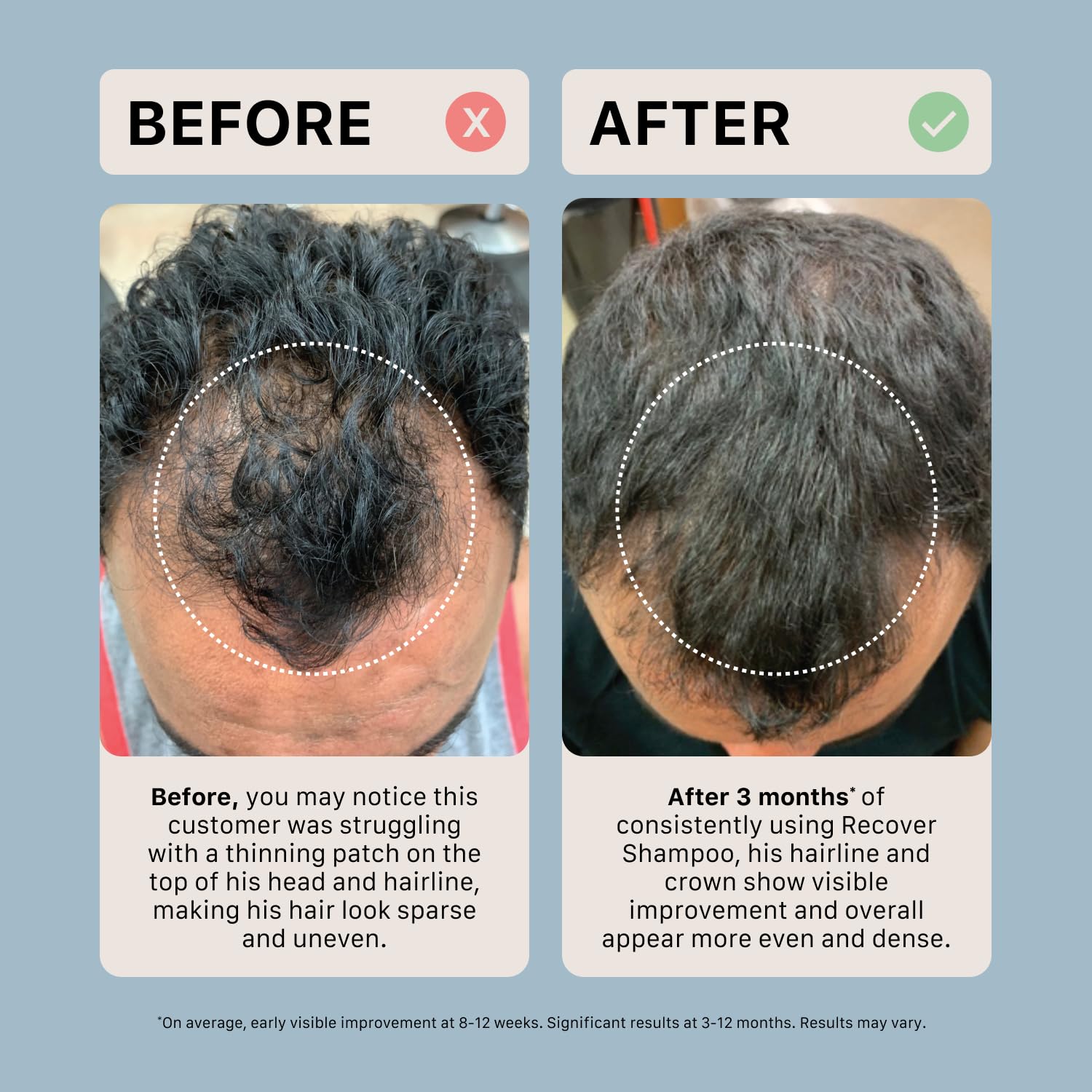 ACTIIV Recover thickening shampoo being applied during routine for fuller-looking hair.