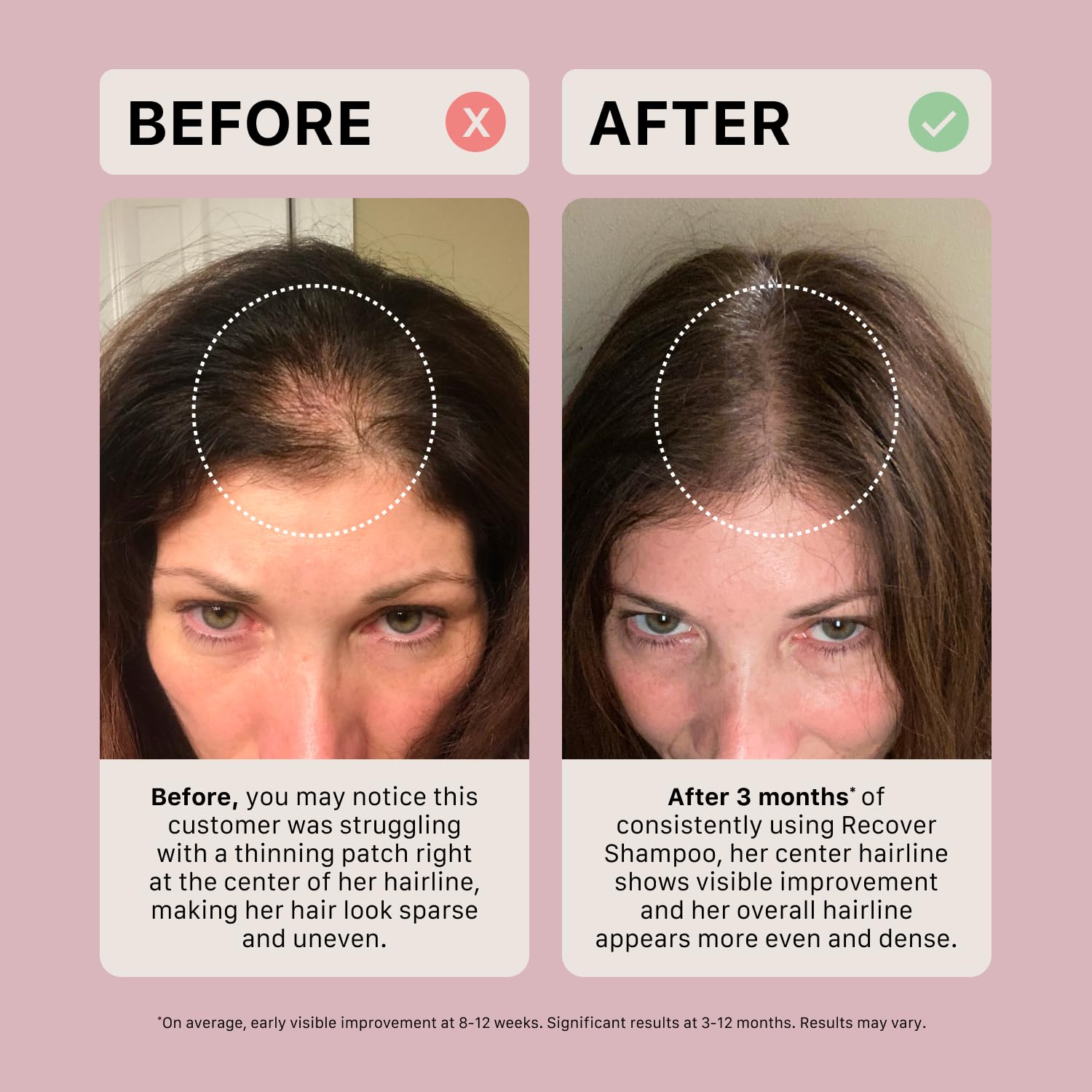 Color-safe ACTIIV Recover thickening shampoo suitable for color-treated hair.
