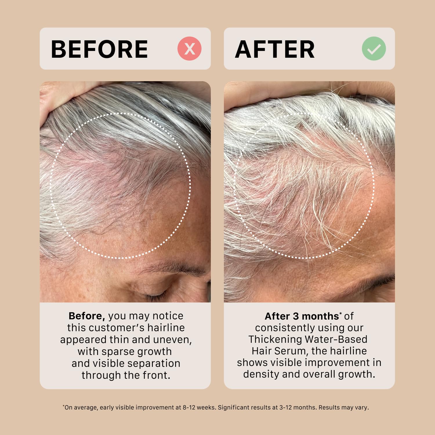 ACTIIV Ultimate Power Trio foam lather demonstrates cleansing action suitable for use