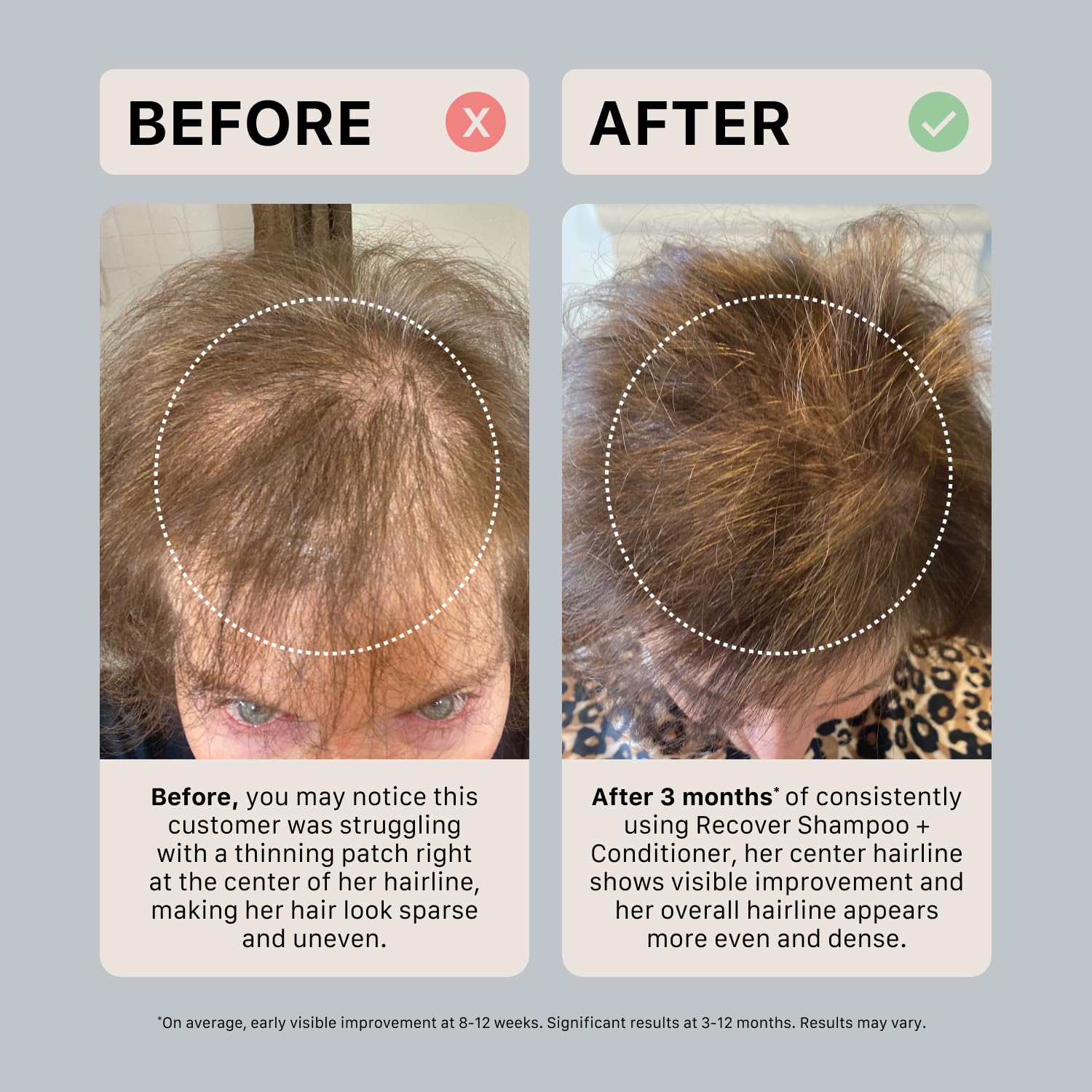 ACTIIV Recover Thickening Conditioner packaging size details