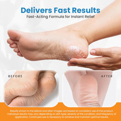 activelife Revitaderm 4D Urea Cream botanical complex soothes with Aloe Vera and Chamomile